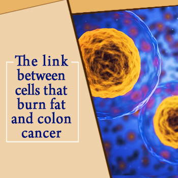 The link between cells that burn fat and colon cancer