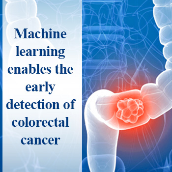 Machine learning enables the early detection of colorectal cancer