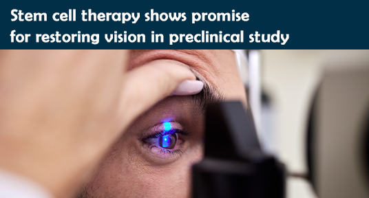 Stem cell therapy shows promise for restoring vision in preclinical study