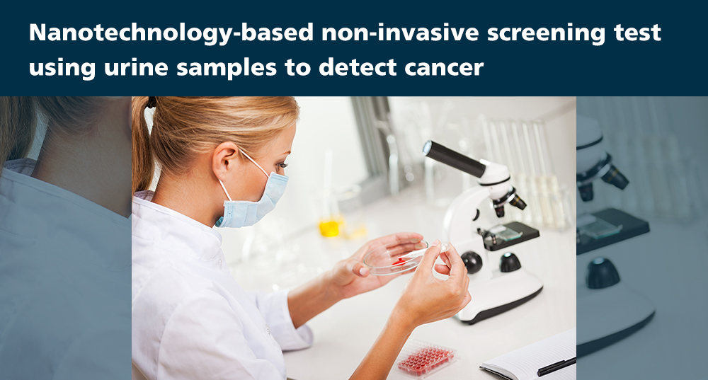 Nanotechnology-based non-invasive screening test using urine samples to detect cancer