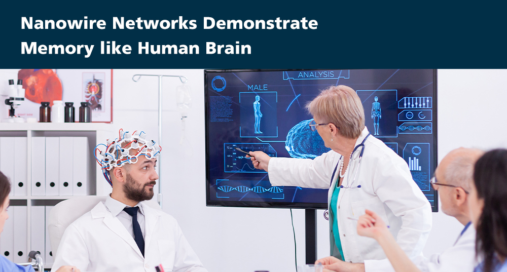 Nanowire Networks Demonstrate Memory like Human Brain