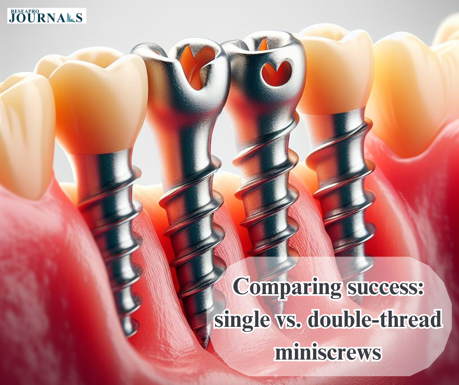 Comparing success: single vs. double-thread miniscrews