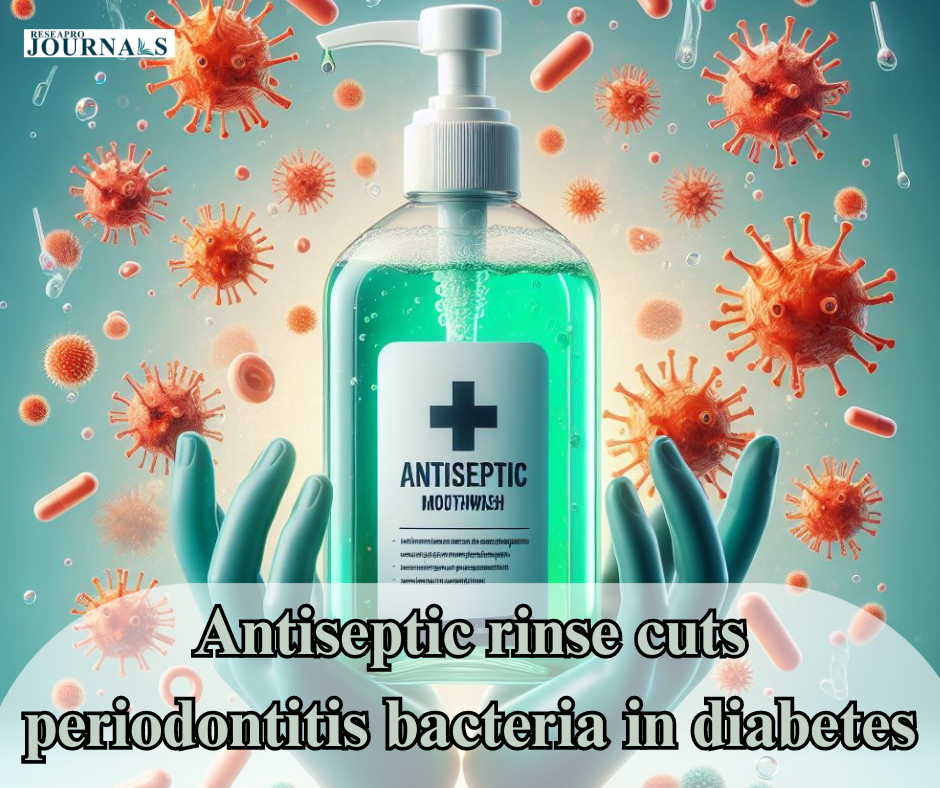 Antiseptic rinse cuts periodontitis bacteria in diabetes