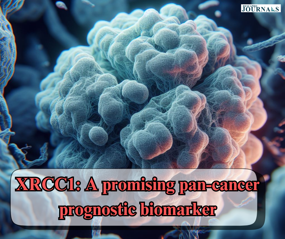XRCC1: A promising pan-cancer prognostic biomarker