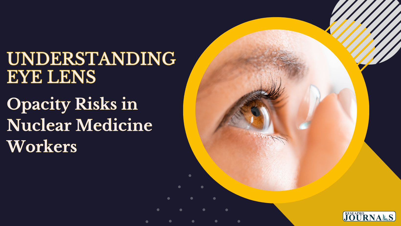 Understanding Eye Lens Opacity Risks in Nuclear Medicine Workers